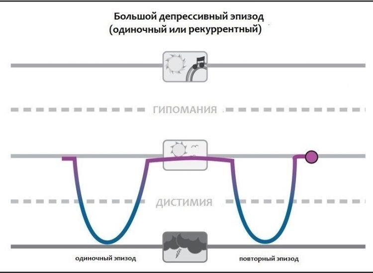 Большое депрессивное расстройство